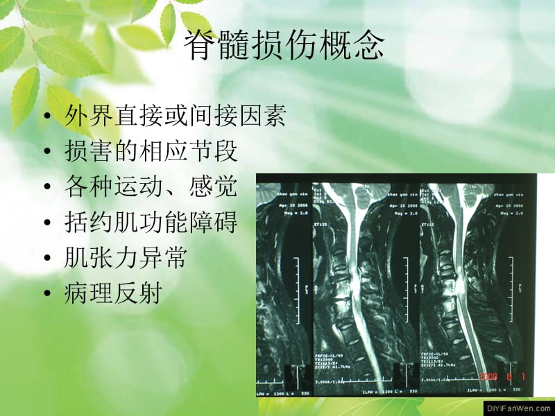 脊髓损伤最新突破，重塑康复的希望之光