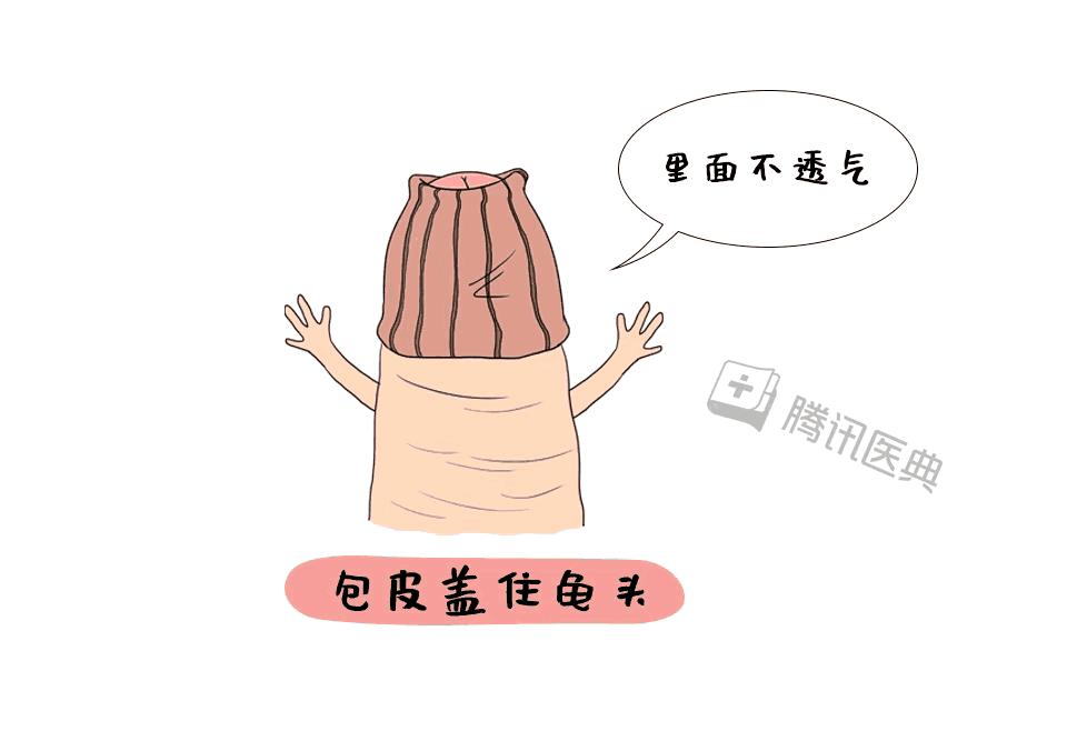 最新割包皮技术，引领医疗进步的新里程碑